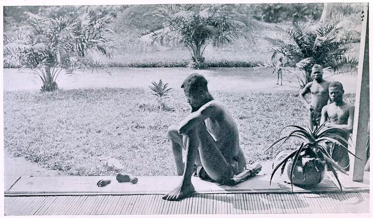 A Congolese man looks at the severed hand and foot of his five-year-old daughter who was killed by members of the Anglo-Belgian India Rubber Company militia in the Belgian colony of the Congo Free State, 1904